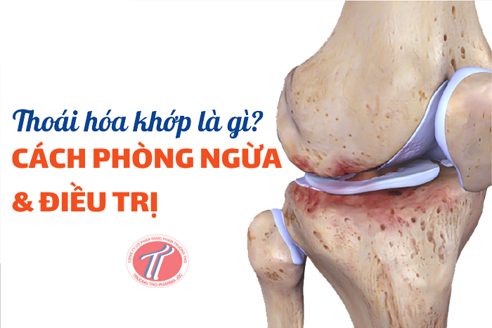 cach-phong-ngua-va-dieu-tri-thoai-hoa-khop-truong-tho-pharma